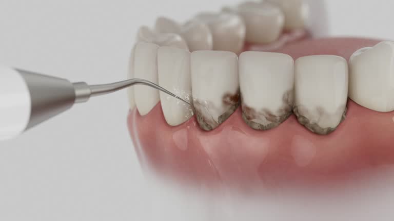 Reliable Dental Implants contractor in Athens, PA by Smile Center Dentistry
